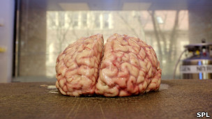 人類大腦
