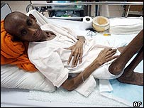 Aids là bệnh mà người ta ''biết rõ nhất''