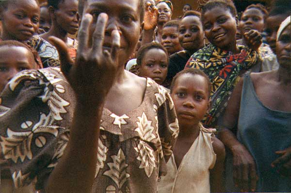 Woman patient with missing finger