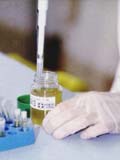 Bottle and pipette