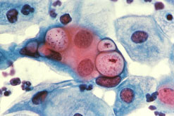 Chlamydia testing by post