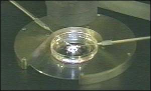 IVF treatment