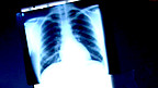 Structure of the Lungs