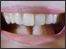 A mouth