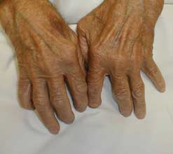 hands