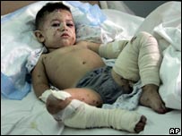 _41897692_child_203ap.jpg