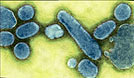 Influenza pandemic 
