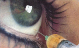 eye