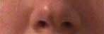 Nose