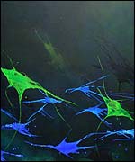 Pic: Nuerons, sensory , from a series by Pam Winbolt .