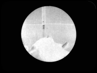 45
