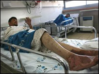 Militante do Fatah em hospital israelense