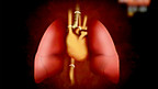 Heart and Lung Transplant