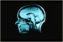 brain