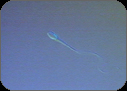 Sperm Cell