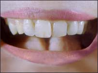 A mouth