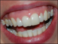 Laugh