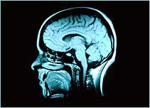 Scan of the human brain