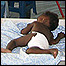 Foto: Susan Sandars/MSF