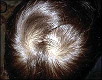 Cabelo