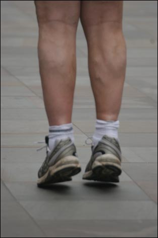 Dave Bradley's legs at the Pancake Day race outside the Guildhall in Worcester.