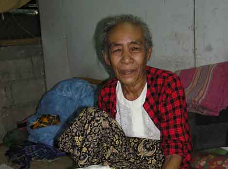 Burmese woman had to have her leg amputated