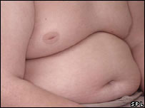 Menino gordo