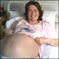 Julie before the birth of the triplets