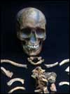 A skeleton