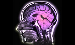 MRI Scan of the Human Brain in Profile