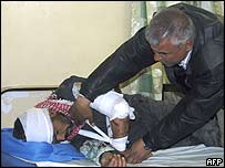 جنازے پر حملے کا زخمی