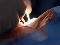 Cirurgia