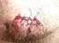 Thruster's chin injury