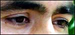 Abdul's eyes