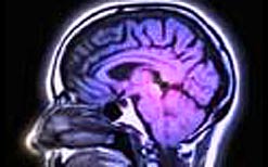 Brain Scan
