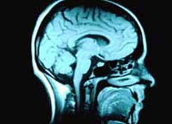 brain scan
