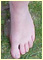 foot