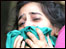 धमाकों में घायल महिला