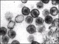 Vírus HIV 
