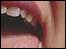 A mouth