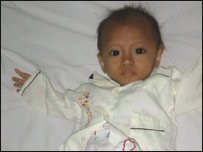 HIV'li bebek