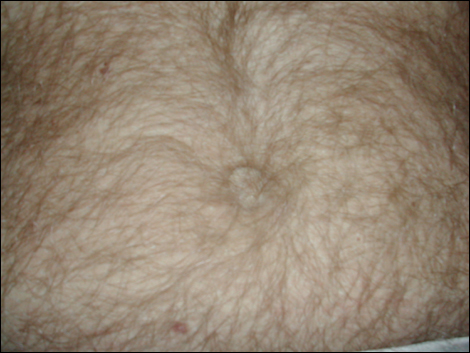 Belly