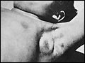 a buboe appearing under the arm pit.