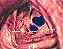 Intestino